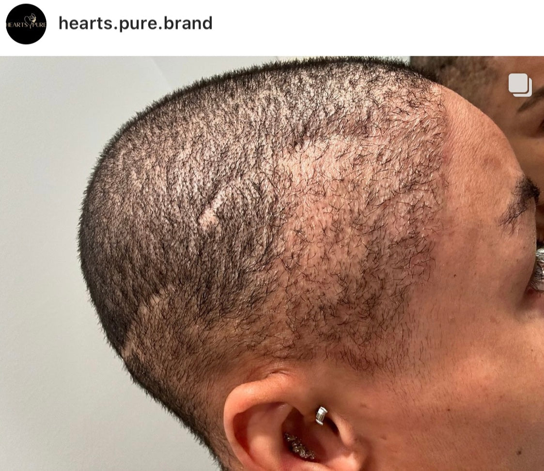 Hair Growth Oil Bundle Deal